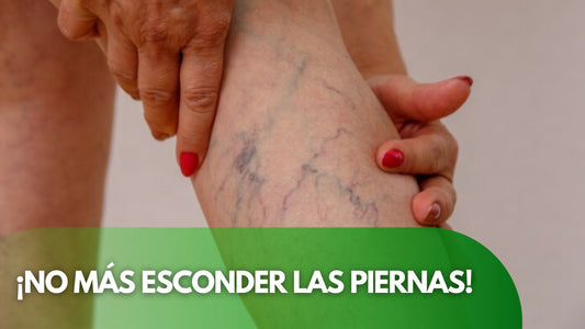 ¡NO MÁS ESCONDER LAS PIERNAS!